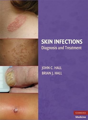 Stock image for Skin Infections for sale by Blackwell's