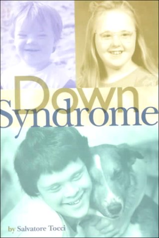 Beispielbild fr Down Syndrome zum Verkauf von Better World Books