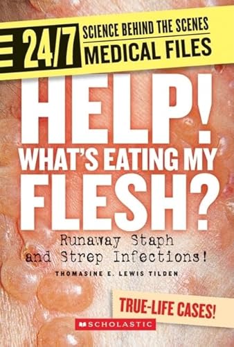 Stock image for Help! Whats Eating My Flesh?: Runaway Staph and Strep Infections! for sale by ThriftBooks-Atlanta