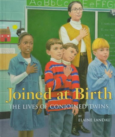 9780531203316: Joined at Birth: The Lives of Conjoined Twins