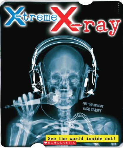 9780545218474: X-Treme X-ray: See the World Inside Out!