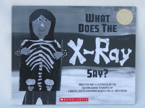 Stock image for What Does the X-Ray Say? for sale by Gulf Coast Books