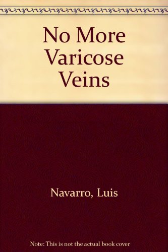 9780553272246: No More Varicose Veins