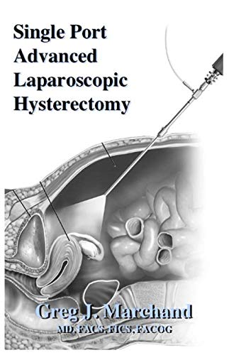 Stock image for Single Port Advanced Laparoscopic Hysterectomy: An Advanced Ultra-Minimally Invasive Surgical Technique for sale by GF Books, Inc.