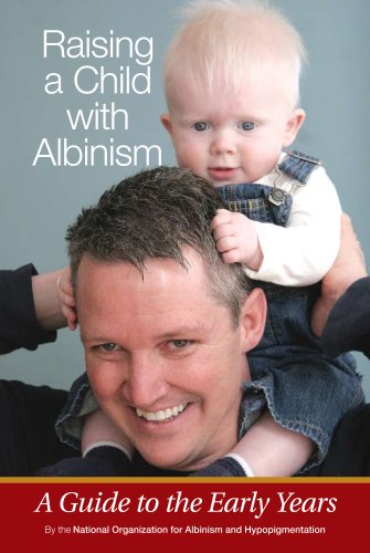 Beispielbild fr Raising a Child with Albinism: A Guide to the Early Years zum Verkauf von ThriftBooks-Atlanta