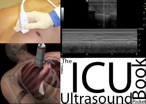 Stock image for The ICU Ultrasound Pocket Book for sale by Salish Sea Books