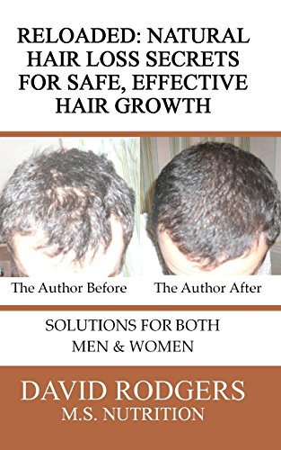 Beispielbild fr Reloaded: Natural Hair Loss Secrets for Safe, Effective Hair Growth zum Verkauf von ThriftBooks-Atlanta