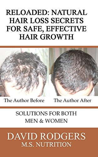 9780615563831: Reloaded: Natural Hair Loss Secrets for Safe, Effective Hair Growth