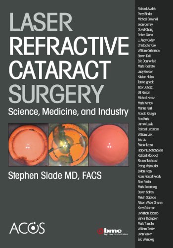 9780615608679: Laser Refractive Cataract Surgery: Science, Medicine, and Industry