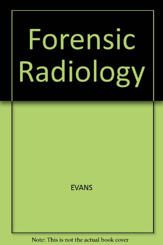 Forensic Radiology (9780632005871) by Kenneth T. Evans; Bernard Knight