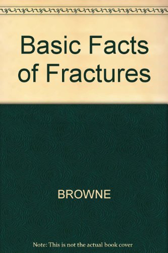 Basic Facts Of Fractures
