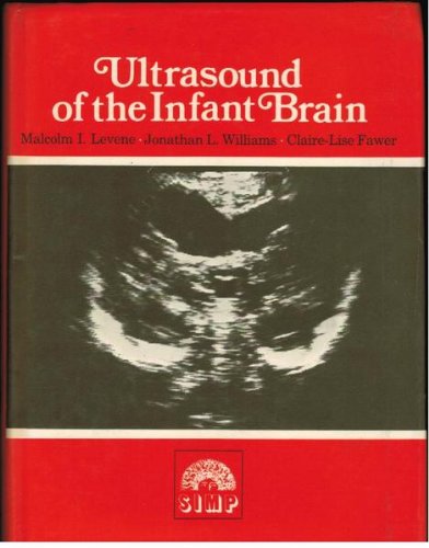 9780632013272: Ultrasound Inf Brain Cdm 92