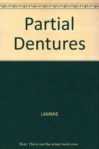 9780632015986: Partial Dentures