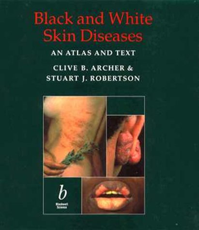 Beispielbild fr Black and White Skin Diseases: An Atlas and Text zum Verkauf von WorldofBooks