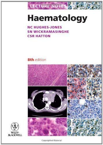 Stock image for Lecture Notes on Hematology for sale by Better World Books