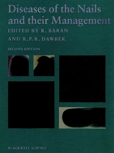 Stock image for Diseases of the Nails and Their Management Dawber, R. P. R. and Baran, R. for sale by online-buch-de