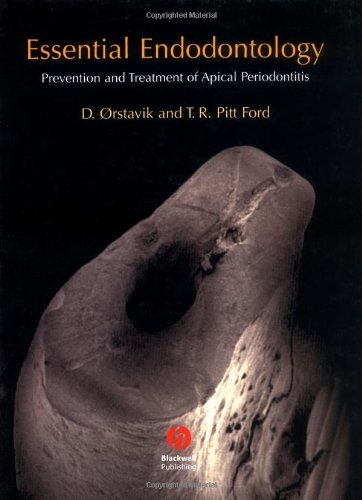 Stock image for Essential Endodontology: Prevention and Treatment of Apical Periodontitis for sale by HPB-Red