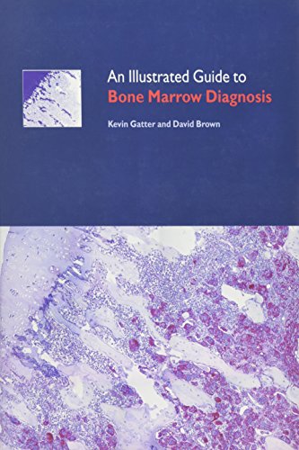 An Illustrated Guide to Bone Marrow Diagnosis