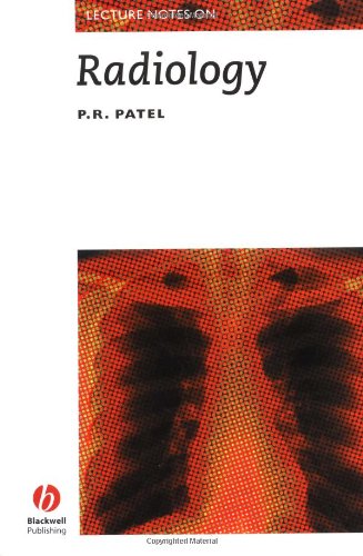 Beispielbild fr Lecture Notes on Radiology zum Verkauf von Better World Books