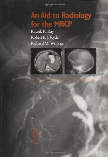 Imagen de archivo de An Aid to Radiology for the MRCP a la venta por Better World Books Ltd