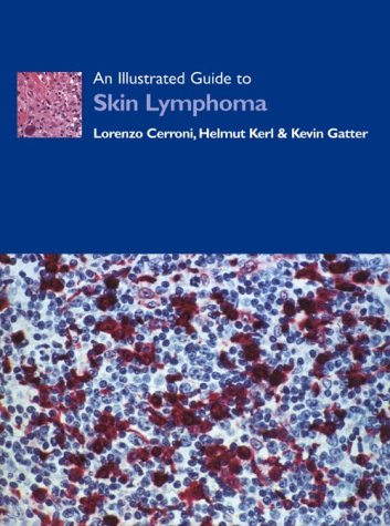 An Illustrated Guide to Skin Lymphoma (9780632050826) by Cerroni, Lorenzo; Kerl, Helmut; Gatter, Kevin