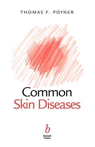 Beispielbild fr Common Skin Diseases zum Verkauf von Blackwell's