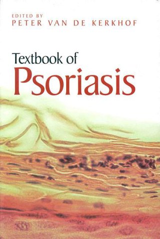 Beispielbild fr Textbook of Psoriasis zum Verkauf von Irish Booksellers