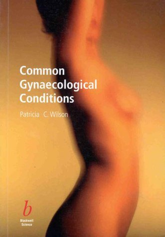 9780632051748: Common Gynaecological Problems