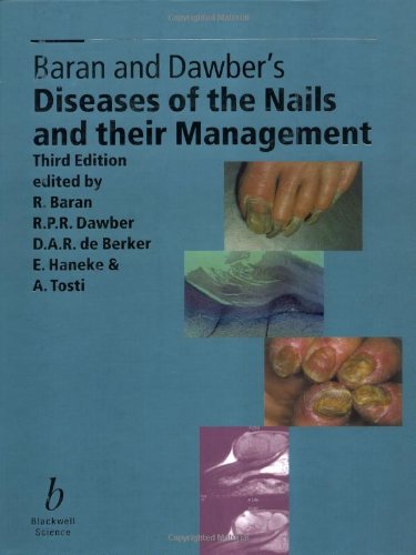 Stock image for Baran and Dawber?s Diseases of the Nails and their Management for sale by WorldofBooks