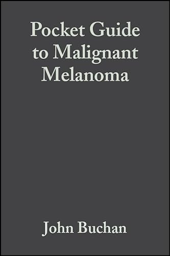 Imagen de archivo de Pocket Guide to Malignant Melanoma a la venta por Better World Books