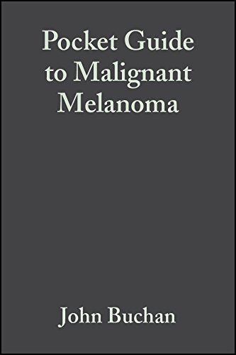 Stock image for Pocket Guide to Malignant Melanoma for sale by Better World Books