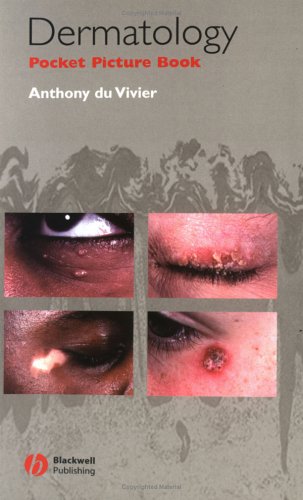 Dermatology Pocket Picture Book (9780632054282) by DuVivier, Anthony; Du Vivier, Anthony; Sprigings, David