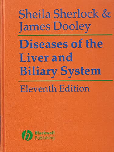 Beispielbild fr Diseases of the Liver and Biliary System zum Verkauf von medimops