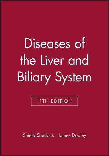 9780632055821: Diseases of the Liver and Biliary System