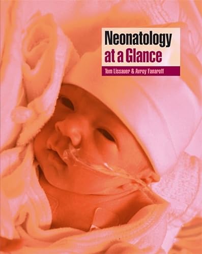 9780632055975: Neonatology at a Glance