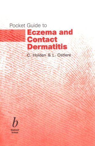 9780632056637: Pocket Guide to Eczema and Contact Dermatitis