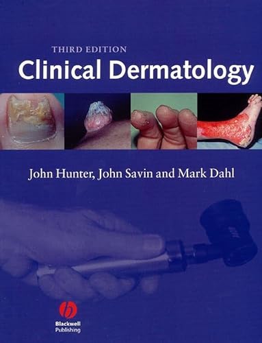 9780632059164: Clinical Dermatology