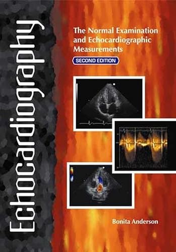 9780646468631: Echocardiography: The Normal Examination and Echocardiographic Measurements