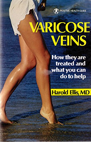 Imagen de archivo de Varicose Veins: How They Are Treated and What You Can Do to Help (Positive Health Guide) a la venta por Book Alley