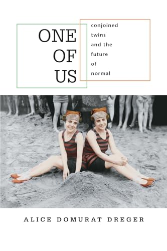 9780674018259: One Of Us: Conjoined Twins And The Future Of Normal