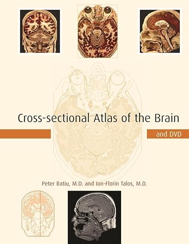 Stock image for Cross-Sectional Atlas of the Brain for sale by Blackwell's