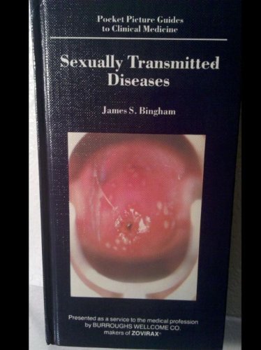 9780683009156: Sexually transmitted diseases (Pocket picture guides to clinical medicine)