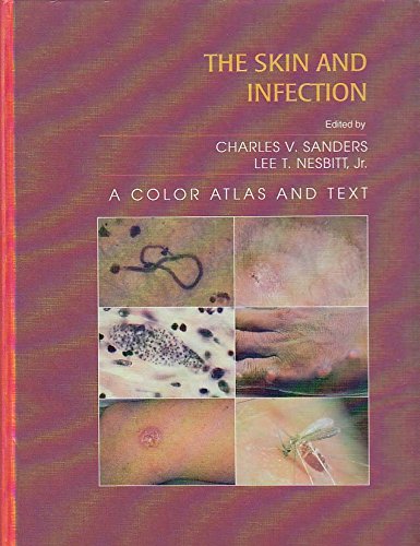 The Skin and Infection: A Color Atlas and Text