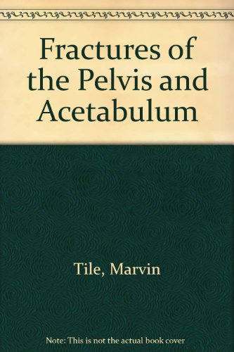 9780683082494: Fractures of the Pelvis and Acetabulum