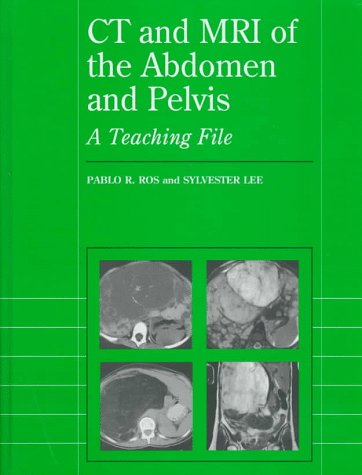 Imagen de archivo de CT and MRI of the Abdomen and Pelvis: A Teaching File a la venta por ThriftBooks-Dallas