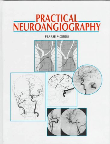 Stock image for Practical Neuroangiography for sale by Wonder Book