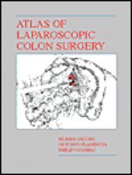 Atlas of Laparoscopic Colon Surgery (9780683300321) by Jacobs, Moises; Plasencia, Gustavo; Caushaj, Philip F.