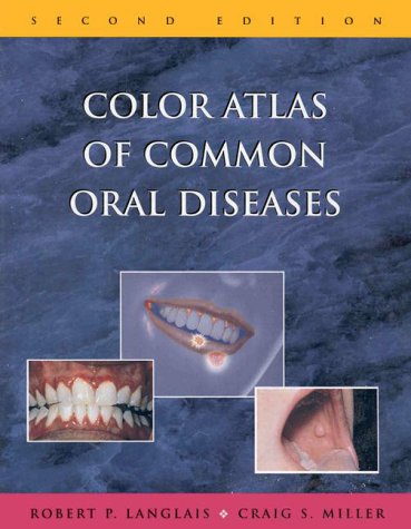 Beispielbild fr Color Atlas of Common Oral Diseases zum Verkauf von Better World Books