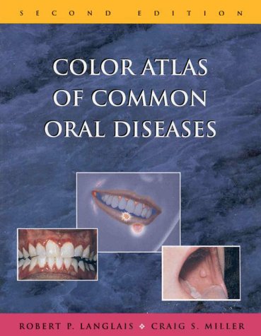 Imagen de archivo de Color Atlas of Common Oral Diseases a la venta por Better World Books