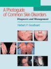 Beispielbild fr A Photoguide of Common Skin Disorders: Diagnosis and Management zum Verkauf von HPB-Red